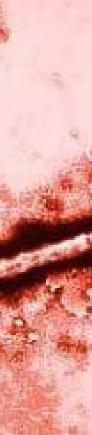 Ebola