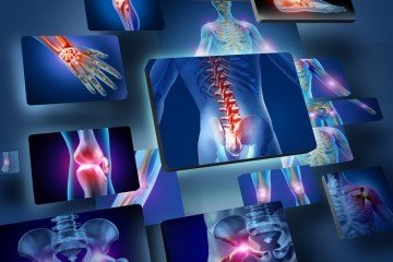 inflammation | Longevity LIVE