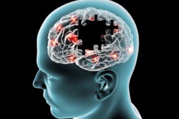brain optimization
