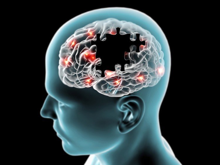 brain optimization