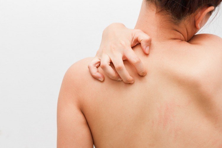 arthritis and cannabis strains