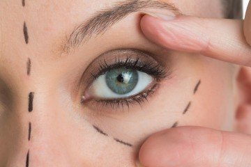 eye bags | Longevity LIVE