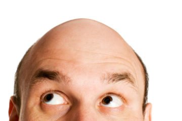 baldness | Longevity LIVE