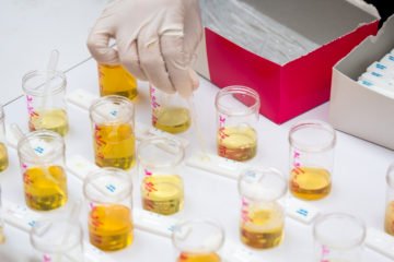 bladder infection | Longevity LIVE