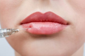 dermal fillers | Longevity LIVE