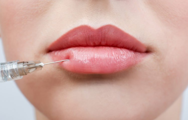 dermal fillers | Longevity LIVE