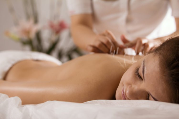 acupuncture | Longevity LIVE