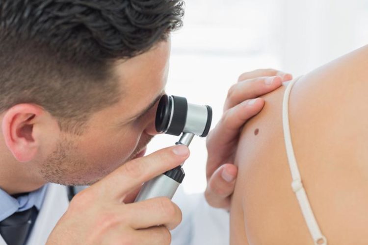 skin cancer | Longevity LIVE