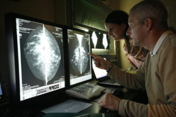 breast implants | Longevity LIVE